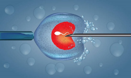 Best Infertility Treatment Clinic in Dombivli
